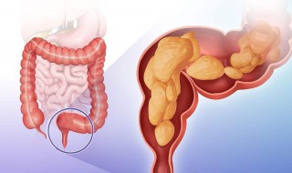 指检是什么意思啊（指检是什么意思啊AWM）